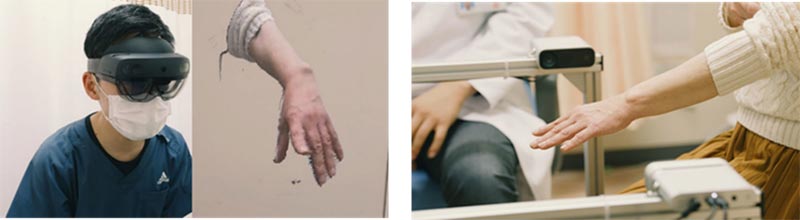 Mixed Reality 技術・人工知能を活用した関節リウマチ診療の実際の様子