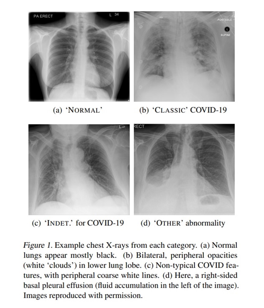 Example chest x-rays from each category