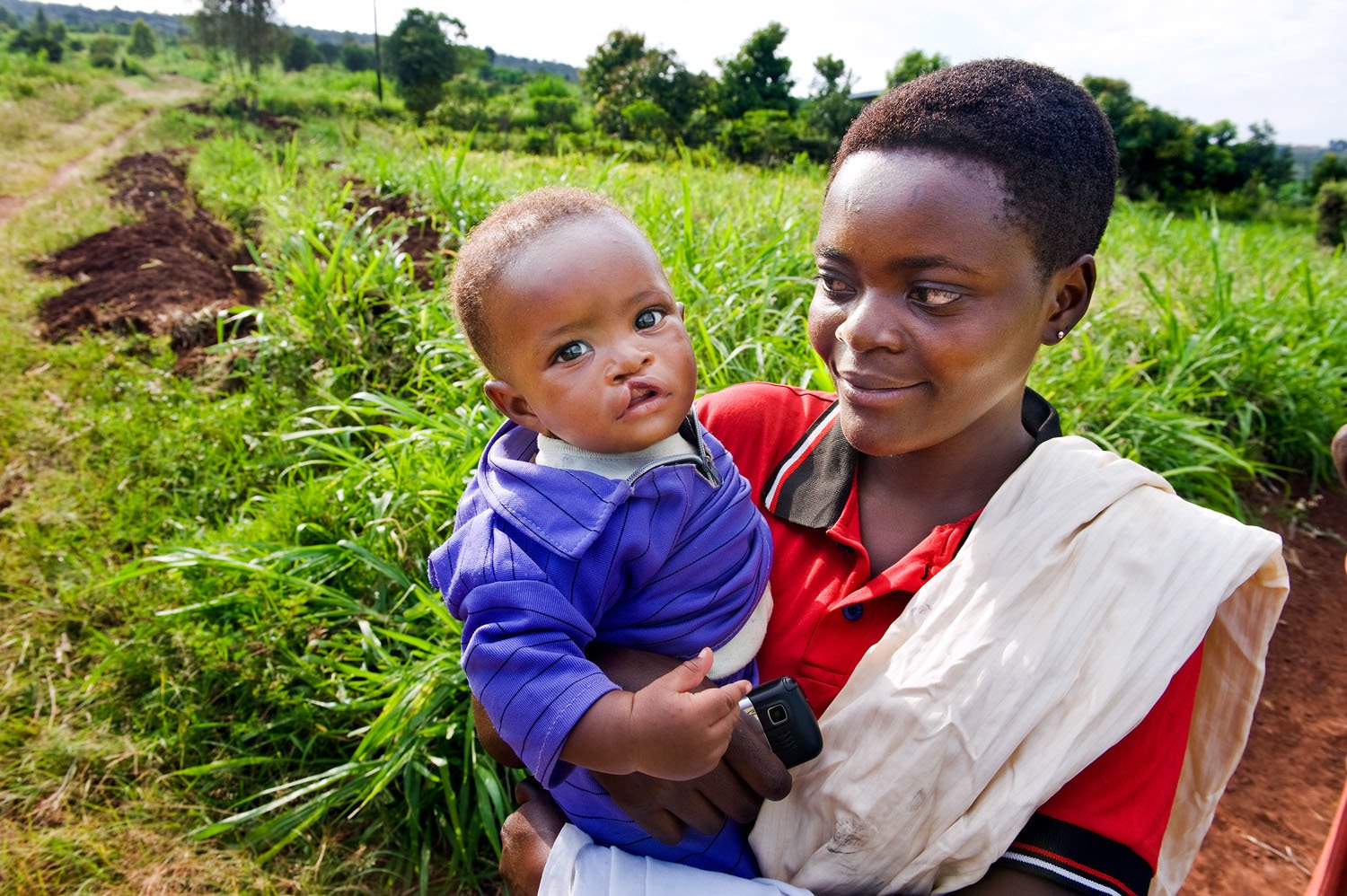 Operation Smile, Rwanda | mother holding a child with a cleft lip