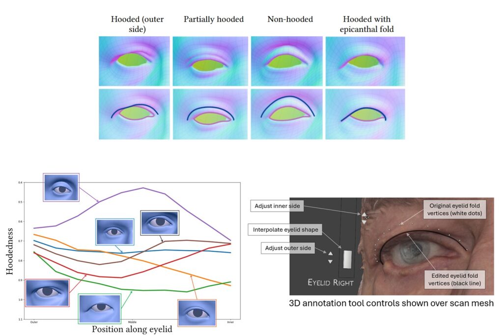 eyelid fold consistency