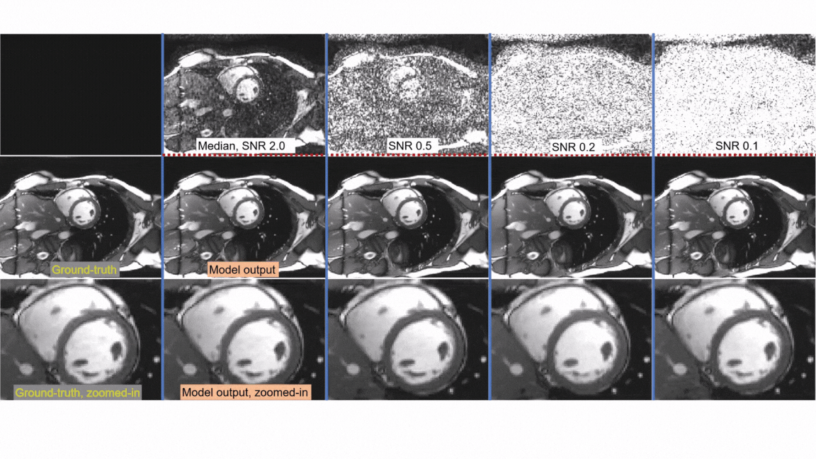The movies correspond to the example in Figure 1b. The ground-truth clean image is the single one on the left.  The first row are the noisy samples. The second row are the SNR images. 