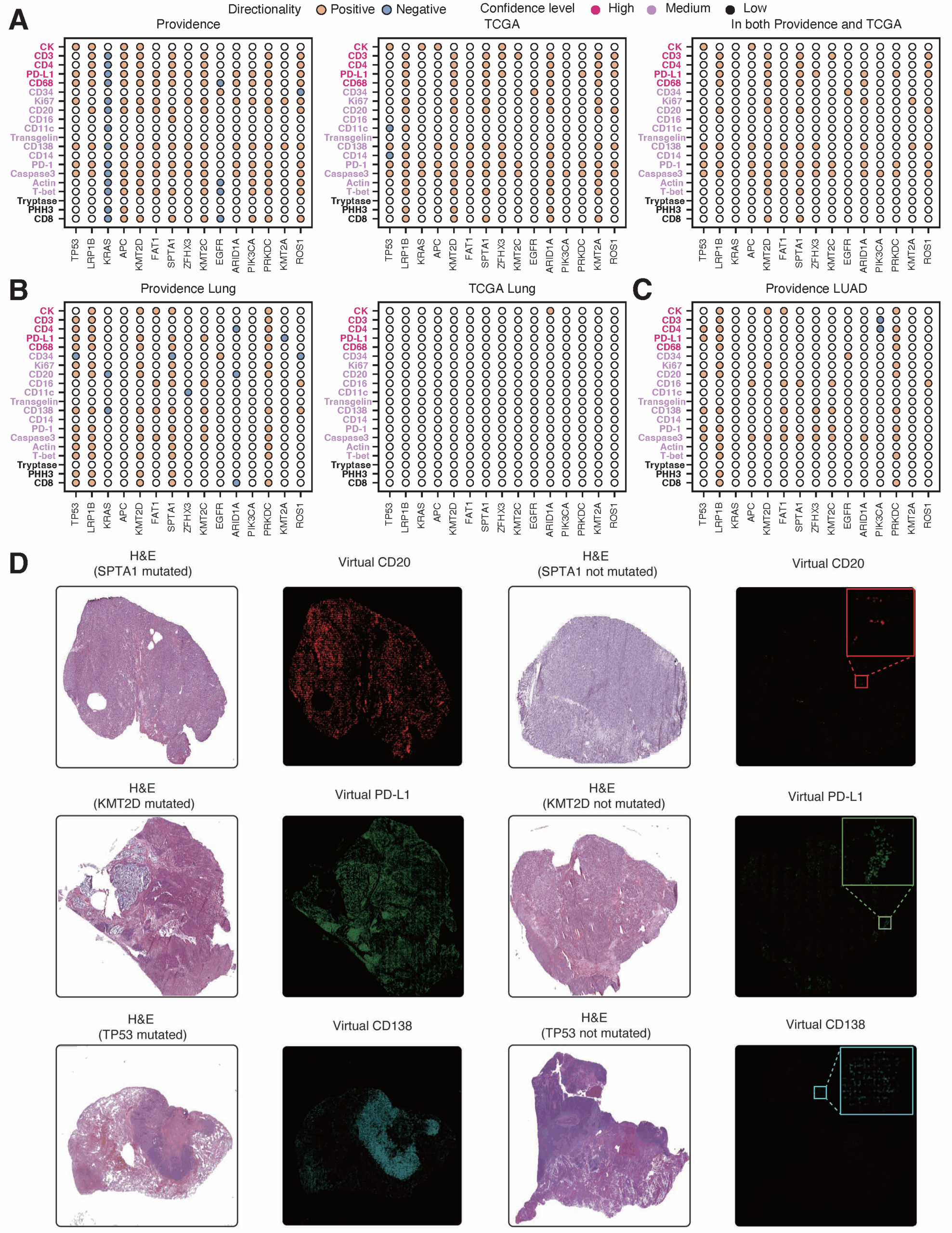 Figure 6. Independent validation on a virtual population from TCGA. A, Grid charts showing significantly correlated pan-cancer GigaTIME protein-biomarker pairs in Providence (left), TCGA (middle), and both (right). B, Grid charts showing significantly correlated GigaTIME protein-biomarker pairs for lung cancer in Providence and TCGA. C, Grid chart showing significantly correlated GigaTIME protein-biomarker pairs for LUAD in Providence. Channel color denotes high, medium, and low confidence based on pearson correlations evaluated using test set. D, Case studies with visualizations of H&E slides and the corresponding virtual mIF activations for the pair of a GigaTIME protein channel and a biomarker (mutated/non-mutated), where the patient with the given mutation demonstrates much higher activation scores for that GigaTIME protein channel.